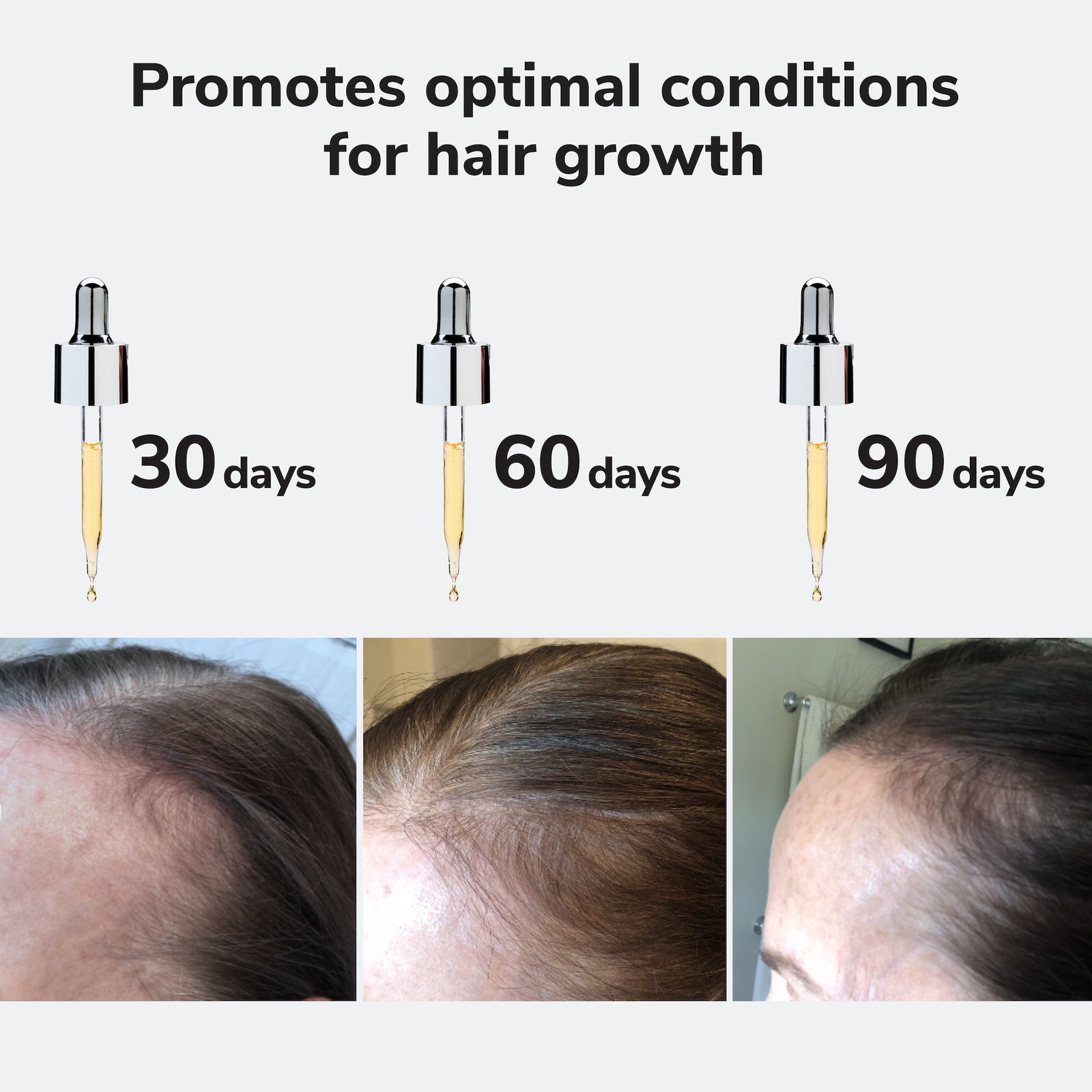 Youth Juice Scalp Serum | Scalp Treatment – Color Wow